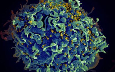 Virus Hiv: impedita la replicazione con nanoparticelle